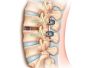 cirurgia-coluna-dra-valeria-neurologista-2